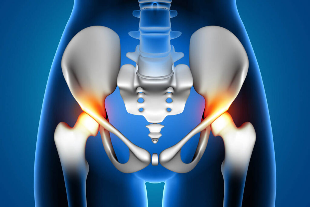 What Causes Hip and Pelvic Pain: Symptoms and Treatment