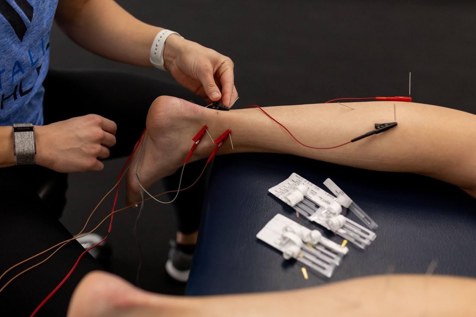 Do you need to rest after a cortisone injection